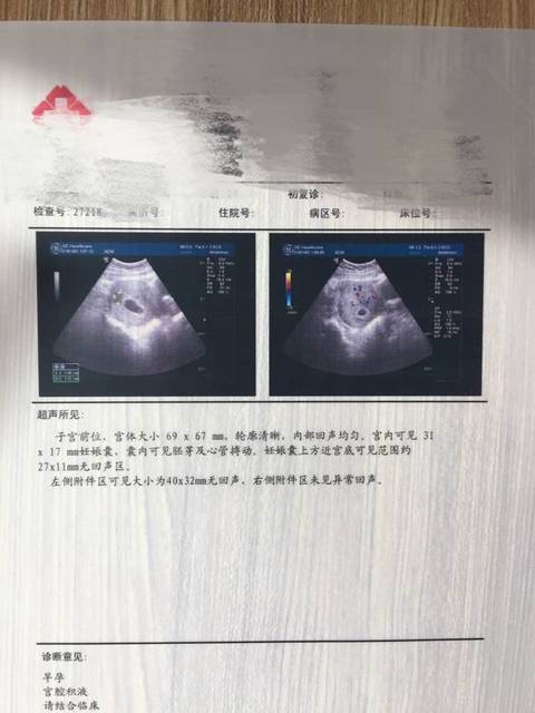 孕50天,今天做彩超了,说有先兆流产的可能