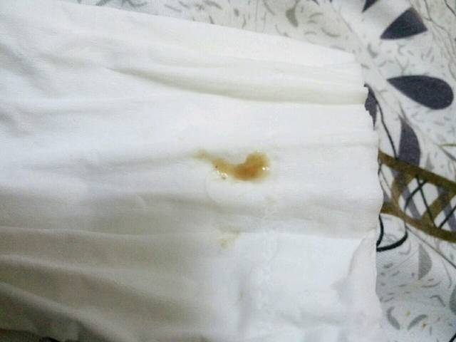 知道的大家帮忙解答下_我怀孕七周了,六周就发