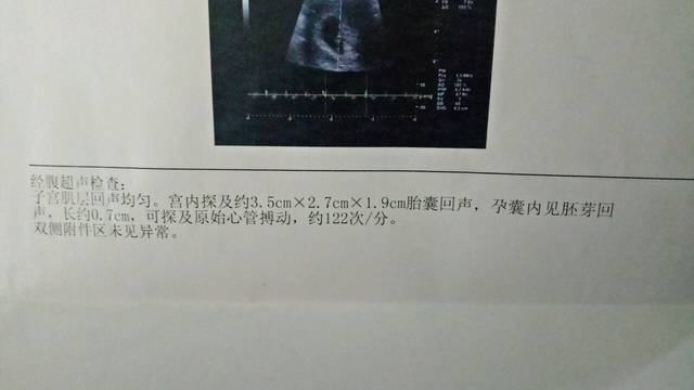 七周有胎心胎芽了,接胎心胎芽了,你们胎儿的心