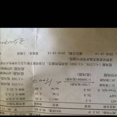 帮我看一下21体是属于高风险吗?做无创DNA准