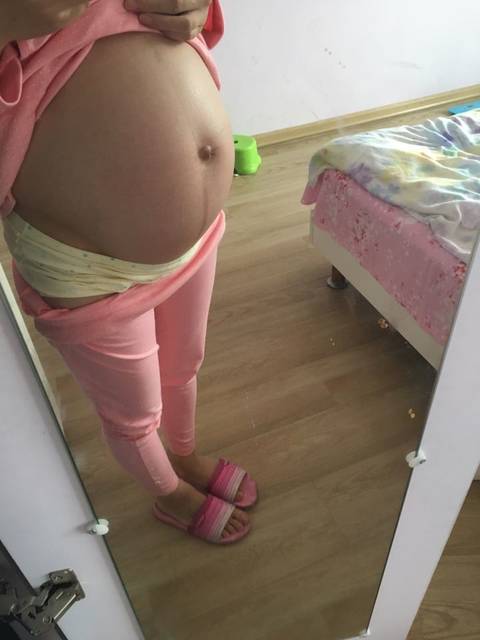 双胎宝妈_24周3了,双胎,肚子超大,孕前53kg现