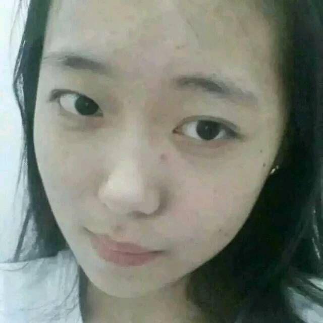 自家自制纯中药祛痘膏_你还在做剩痘士吗?.