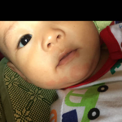 宝妈们 你们看我家宝宝是过敏吗? 每次吃完奶