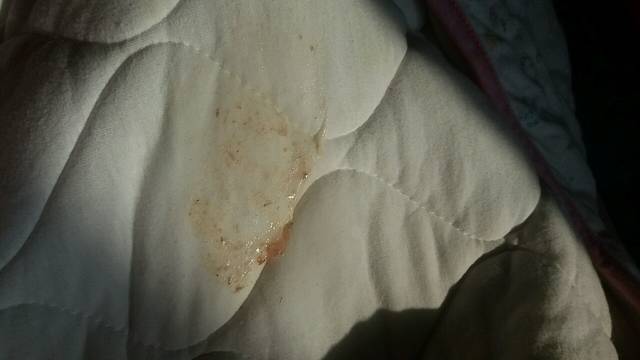 _我家宝早上吃了奶以后一直吐奶,第三次吐了好