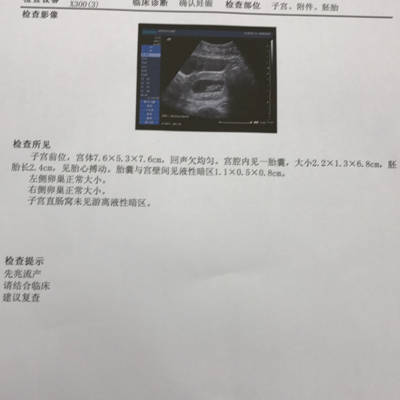 怀孕到今天10周多,报告是上周六检查的,到今天