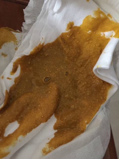 帮忙看看宝宝的大便正常嘛