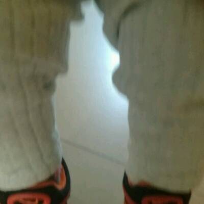 岁四个月宝宝,刚长了八颗牙,两腿一粗一细,走路