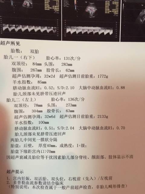 树下 小圈子 家有双胞胎 宝妈们,帮忙看看b超,判断下性别  给予爱123