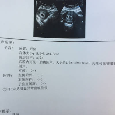 孕6周,没有胎芽胎心,而且小肚子有时候会隐隐作痛,_育儿问答_宝宝树