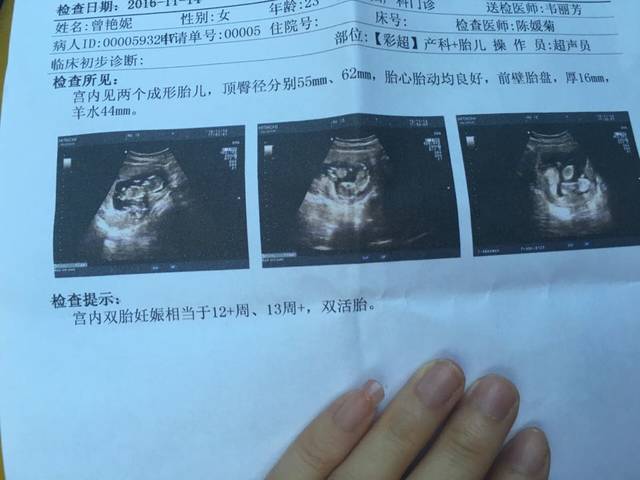双胞胎,怀孕12周,能看出男女吗,嘻嘻_上个月照