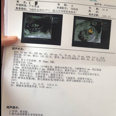 怀孕23周3天查的四维,医生说胎儿头围和腹围比