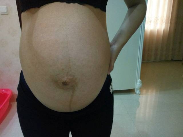 孕晚期肚脐突出一定是男宝吗