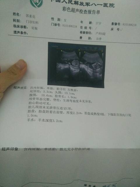 孕14周多,做比超回来是16周数据,偏大两周是男