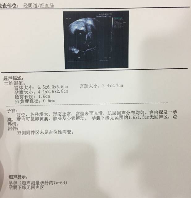 七周+3_复查B超,上周腹部B超有胎心胎芽,另有