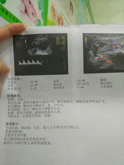 光带是什么意思?_昨天去预约抽羊水,照B超时