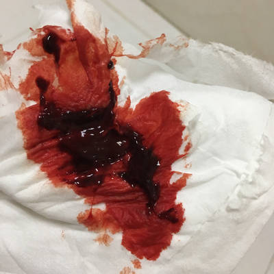 大姨妈第三天的时候突然觉得一热,赶紧去厕所