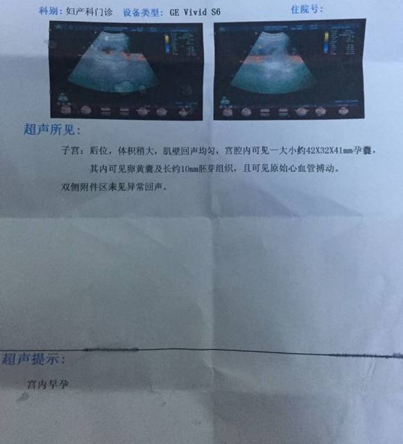 胎心胎芽正常_今天刚去医院做了,腹部彩超,一