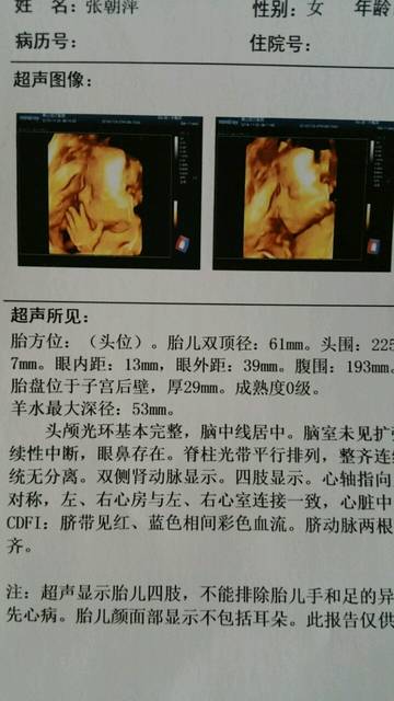 四维通过_今天四维彩超安全通过了,确定是男宝