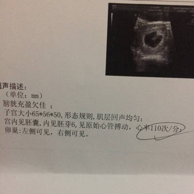 怀孕六周多,胎芽6,胎儿心率慢110怎么办,需要住