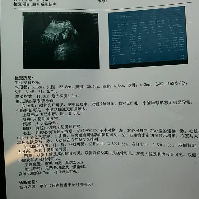 潍坊人民医院的胎儿系统超声检查就是指四维彩