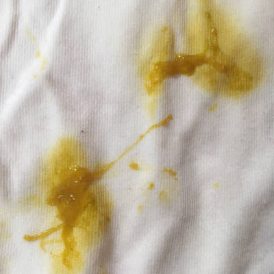 蛋清回事月拉帝王一样的粑粑,这是怎宝宝呀,好心人告诉一下,有图.三个蟹缓冻图片