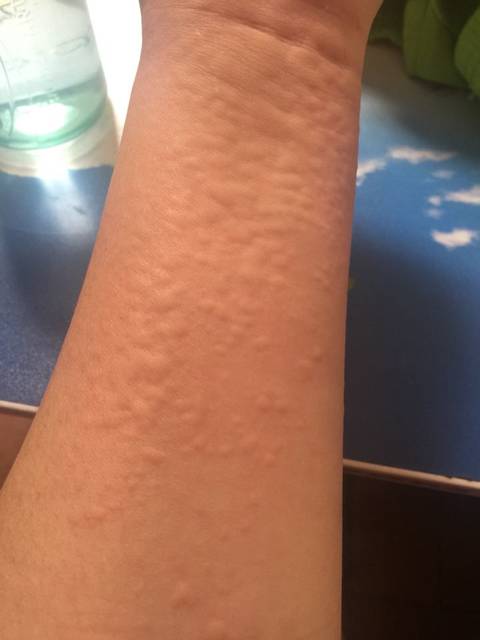 产后体质变了!有没有相同经历的呢?_生完宝宝