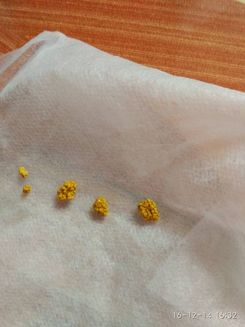 便便有9种颜色,只有3种是健康的(附健康九色卡