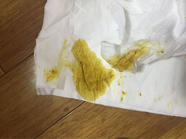 ,宝宝大便_宝宝这几天大便次数越来越多,越来