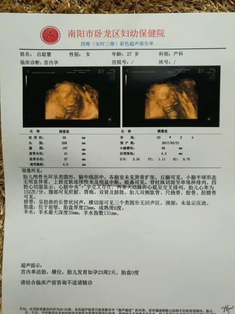 四维单子帮看男孩女孩