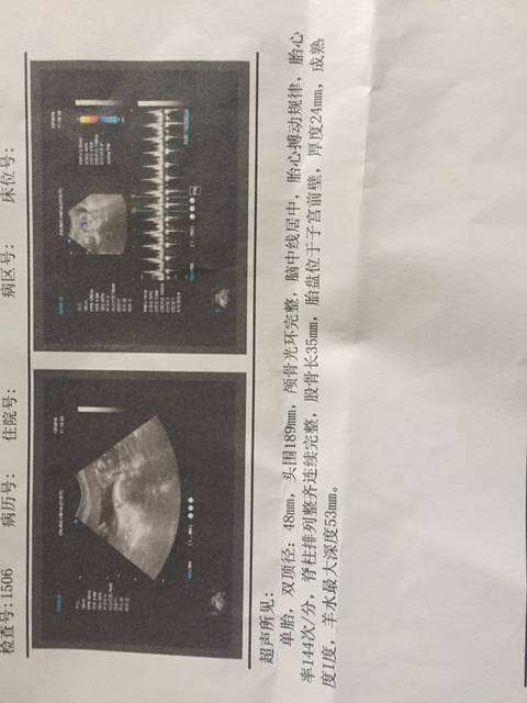 教你B超数据看男女_各位准妈咪们, 大家一宝对