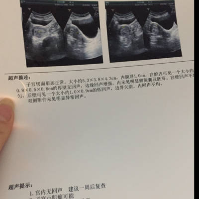 我11月1号来的月经,12月5号用试纸测出已怀孕