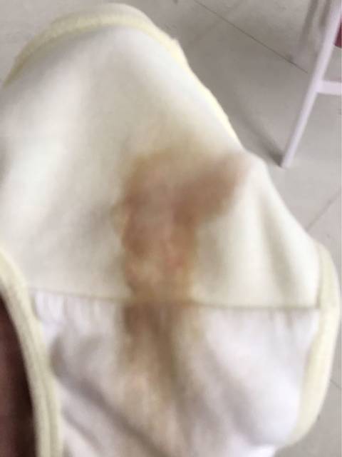 孕妈们快来看看这是见红了吗.有图慎入