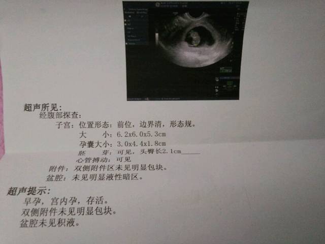 姐妹们无锡哪家无痛人流好_怀孕两个月多了还