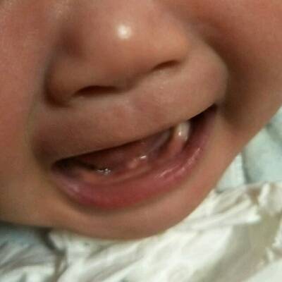 有没有知道宝宝牙床裏面长得是啥的 摸着是硬的