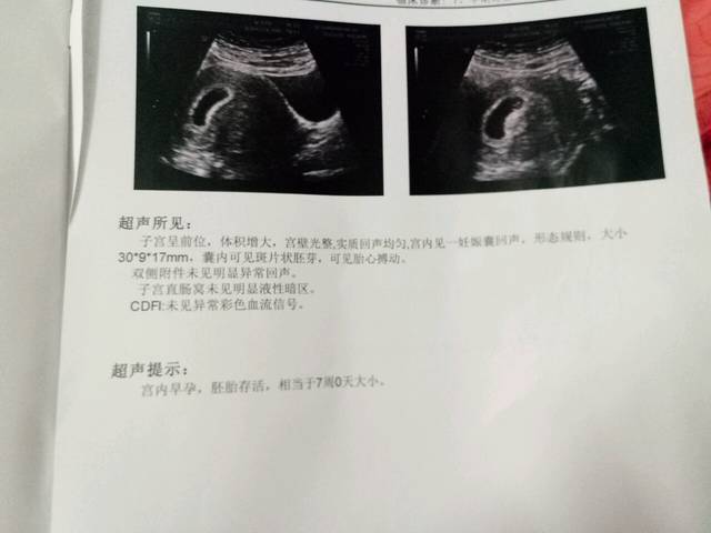 孕七周见胎心胎芽_孕七周昨晚照B超见胎心胎