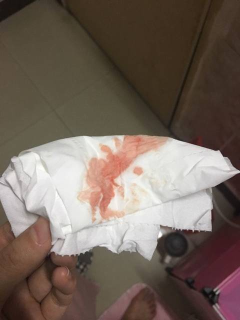 血,在线问,急,谢谢_今天上午11点上厕所纸巾一