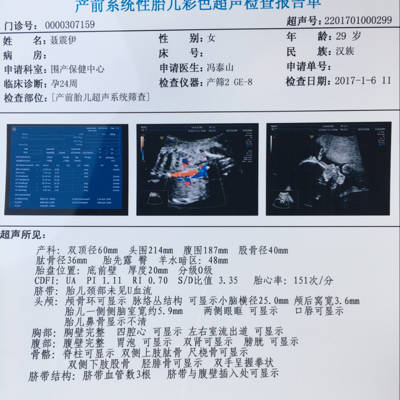 孕24周了,做超声检查说胎儿鼻骨显示不清,13周的时候就是因为鼻骨显示