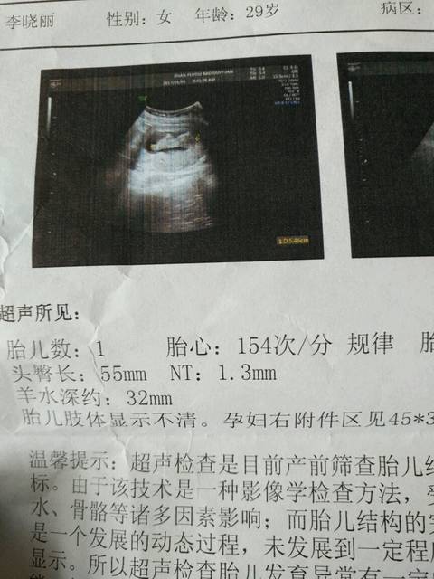 NT结果显示胎儿肢体显示不清怎么回事?有检查