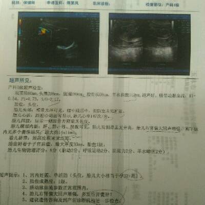 这孩子能要吗,脐带血没问题。一个月之前是产