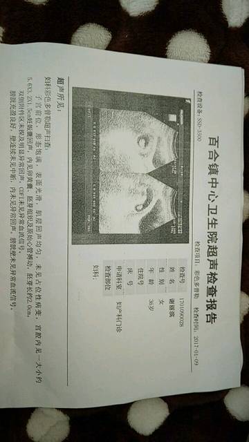 去b超 孕囊像茄子型一样 她们说长茄子形状男宝几率大