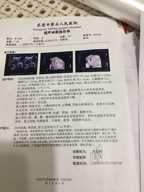 四维结果,右侧双肾孟未见明显分离_24周人民医