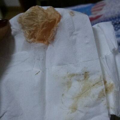 经,排卵是31号,本该这个月10是来月经的,推迟4