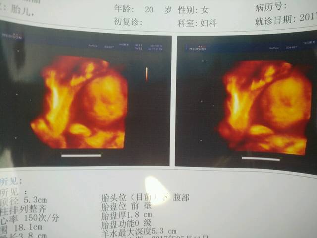 你们好_怀孕五个月了,小腹隐隐作痛,求解?孩子