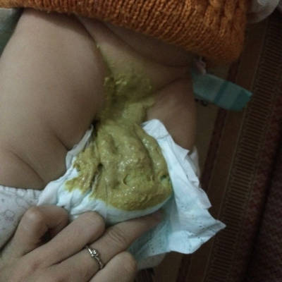 5个月的小孩拉便便是这样的、怎么回事,她吃奶