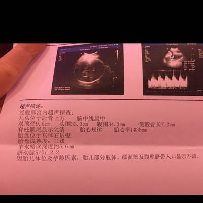 b超单能看出男女吗?