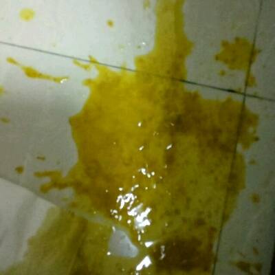 这两天宝宝大便稀,但是次数不多就两三次,吃睡