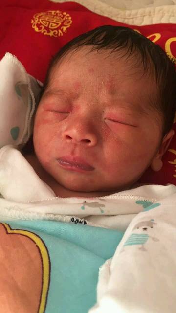 孩子出生两天,脸上和身上红点特别多