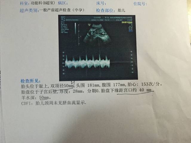 B超单看男女超准的