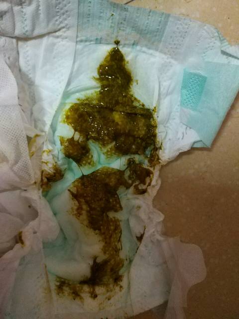 亲们帮我分析分析_亲们,我家宝宝最近感冒嗓子