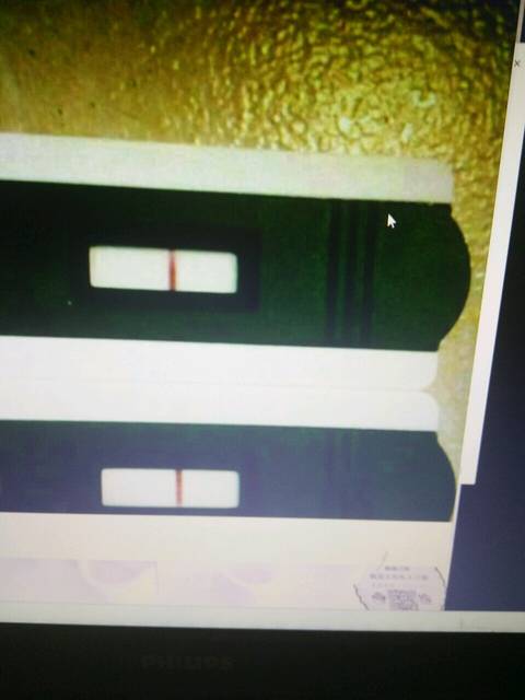 准爆了怀孕一个月就知道宝宝性别了_这样就可